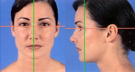 p-sample1 Virtual Plastic Surgery