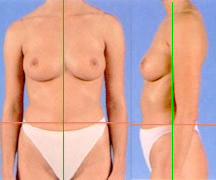 p-sample2 Virtual Plastic Surgery