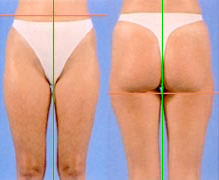 p-sample3 Virtual Plastic Surgery