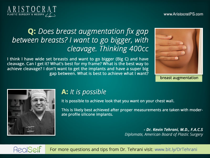 What causes a large gap between breasts after having had a breast  augmentation? (Photo)