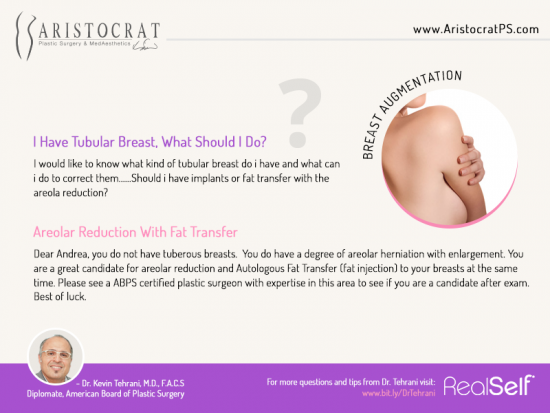 What are the Causes of Tuberous Breasts? - Best Plastic Surgeon in India